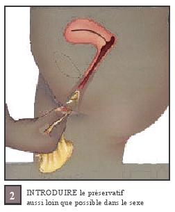 INTRODUIERE le preservatif aussi loin que possible dans le sexe