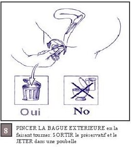 PINCER LA BAGUE EXTERIEURE en la faisant tourner: SORTIR le preservatif et le JETER dans une poubelle